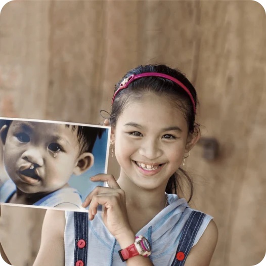 OPERATION SMILE